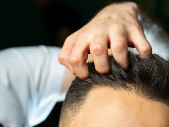 Barber checking a man's hairline and scalp