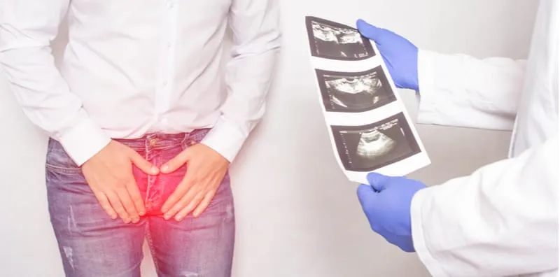 Doctor showing a male patient an ultrasound scan of the prostate