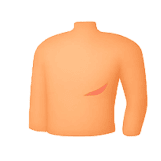 Hepatitis B